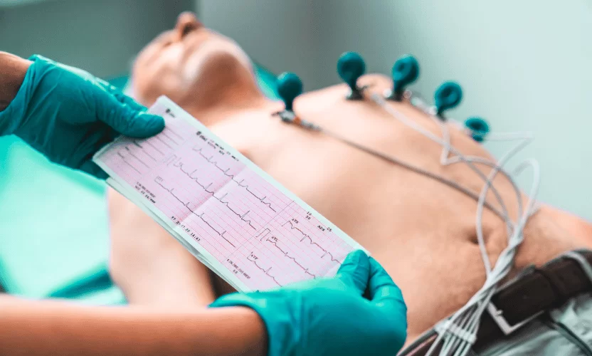 Eletrocardiograma (ECG) O Guia Completo para a Saúde do Seu Coração e a Segurança no Ambiente de Trabalho